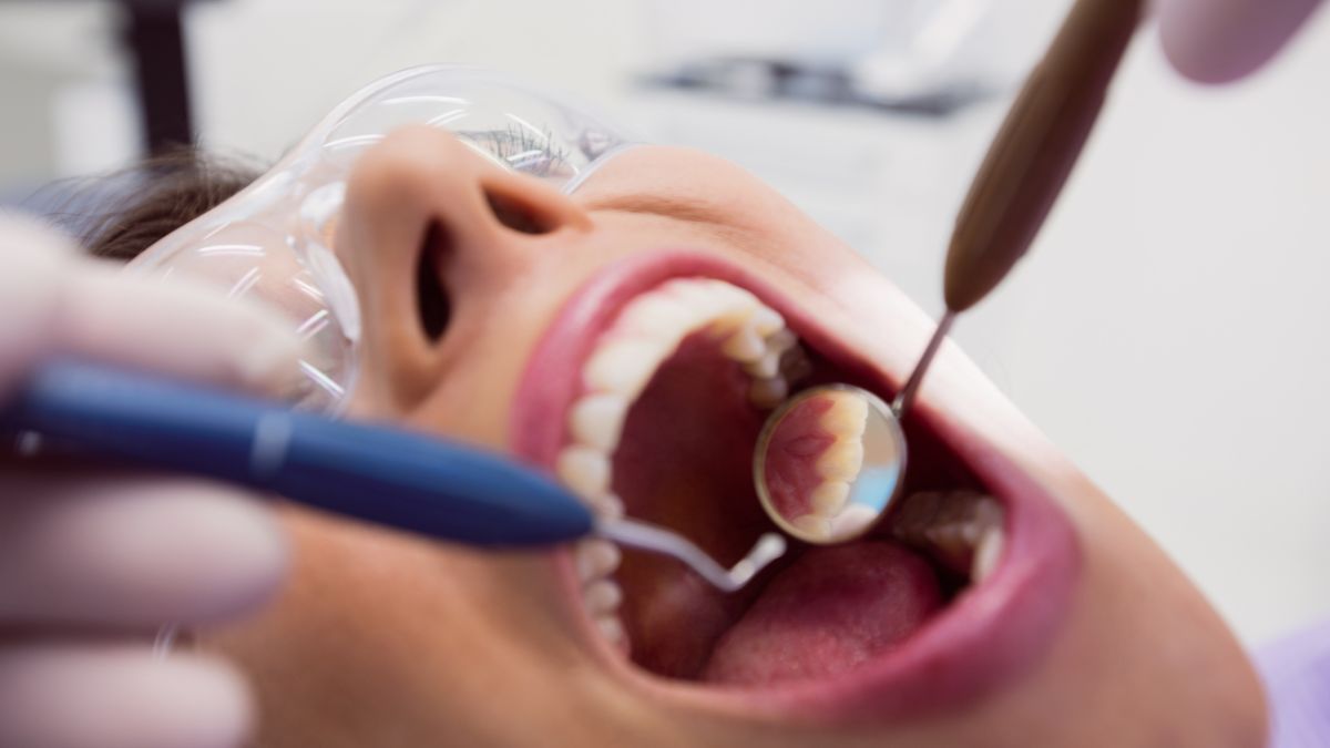 Veja quanto custa um tratamento de canal no dentista